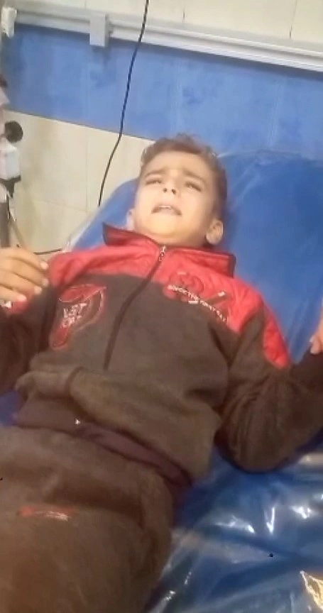İSRAİLİN BOMBALADIĞI BÖLGƏDƏKİ HÜCUMDA YARALANAN UŞAQ NARKOSUZ ƏMƏLİYYAT OLUNARKƏN AĞRILARINI UNUTMAQ ÜÇÜN QURAN-I KƏRİM OXUYUB-VİDEO